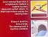 Arix Tonkita Puligenix Dust & Wash System 1Pc